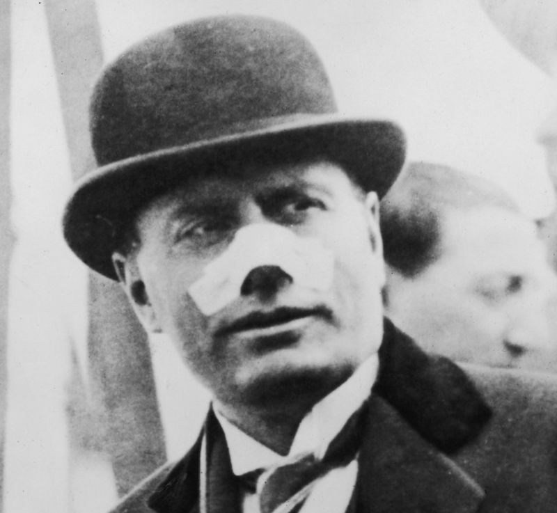 موسوليني  أثناء إصابته في أنفه 