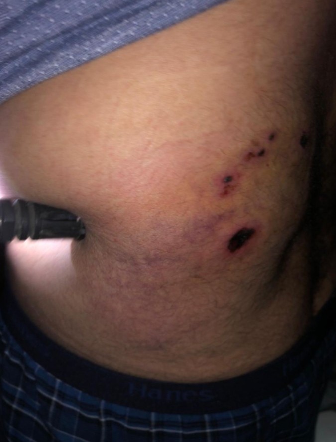 إضاءات الأسير منتصر شبلي 